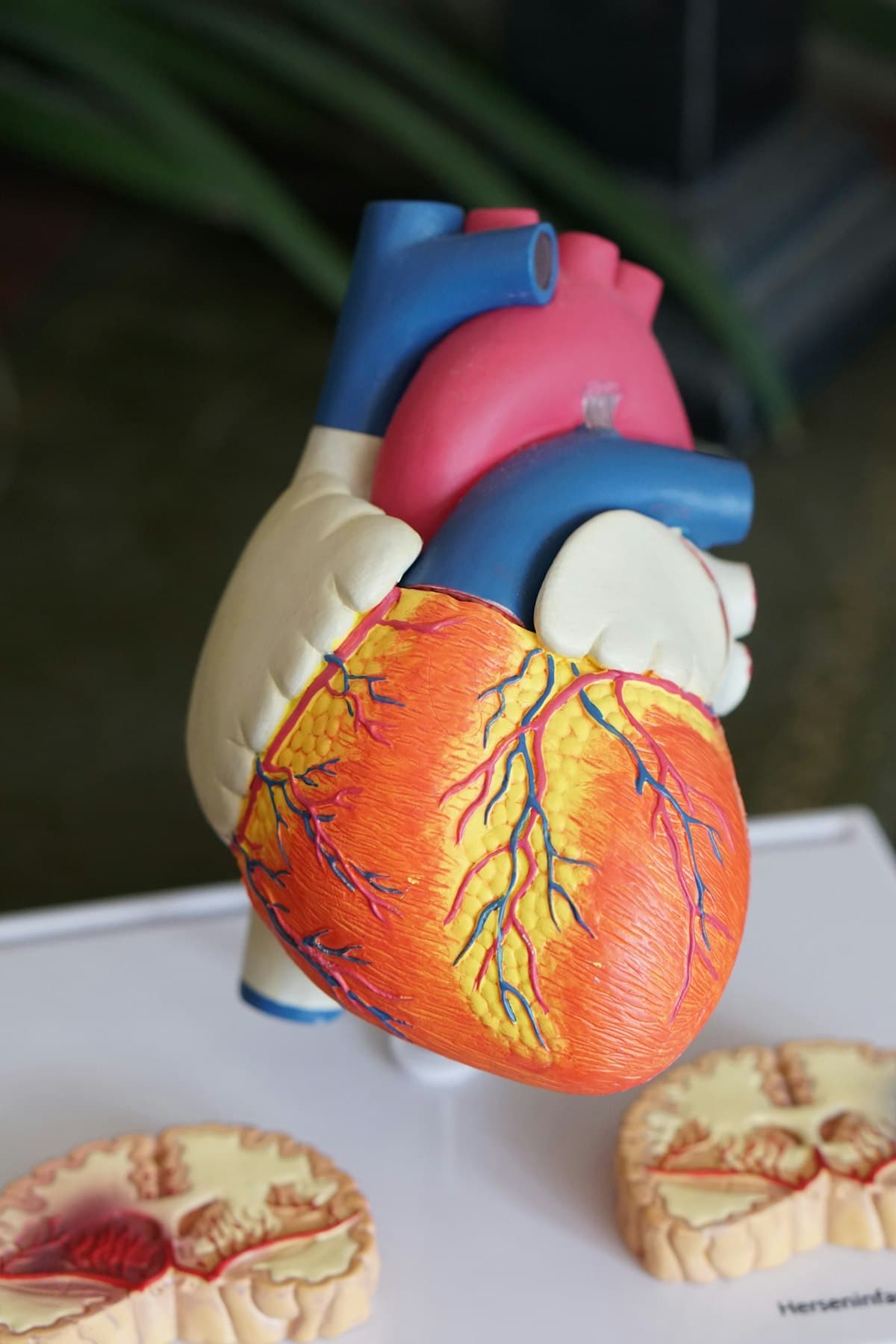 Structural Heart Disease