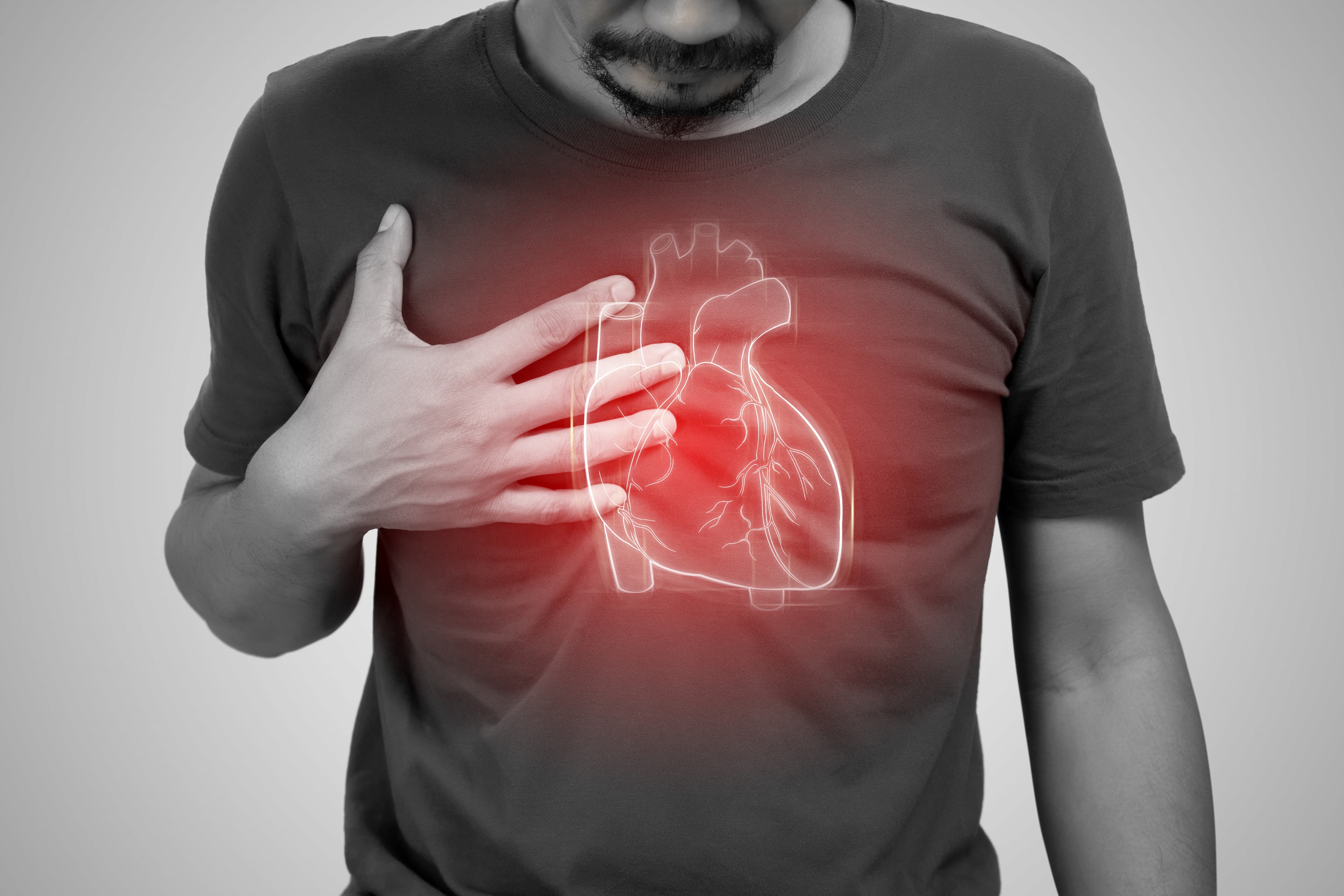 Structural Heart Disease