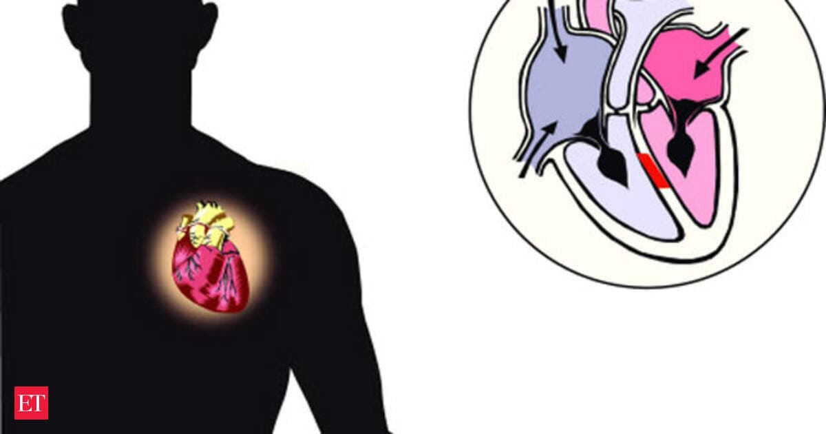 Economic Times article image used with Dr. Godbole’s feature on exercising the heart